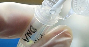 أونلي ليبانون : من قطرة عرق لحبل المشنقة.. أسرار البصمة الوراثية فى فك شفرات القضايا الغامضة