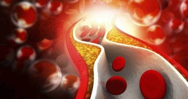 أونلي ليبانون : 8 علامات تحذيرية لجلطات الدم لا يجب تجاهلها