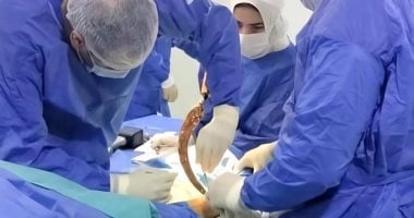 فريق طبى بمستشفى دسوق العام ينقذ قدم طفل دخل جزء من منجل فى قدمه