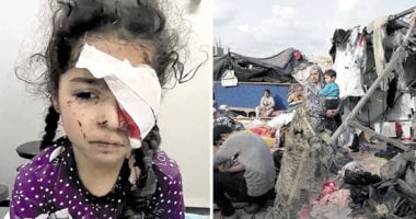 ظلام قسرى.. المئات يفقدون أبصارهم نتيجة القصف بالأسلحة المحرمة دوليا فى غزة.. 1500 فلسطينى فقدوا البصر بسبب الحرب.. 4000 آخرون مهددون بالعمى فى ظل نقص الأدوية.. وطفلة: ضاع حلمى بأن أكون معلمة
