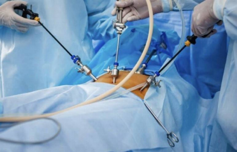 تدخل جراحي عاجل ينقذ حاجة موريتانية من فتق سُرّي مُنخنق بمكة المكرمة
