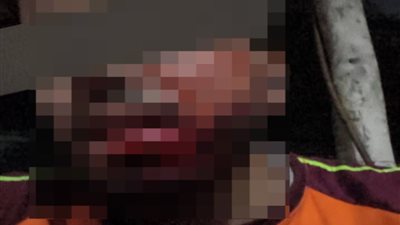 36 غرزة في الوجه بسبب خلاف على ركنة موتوسيكل.. سايس وسكران يعتديان على مندوب توصيل بحدائق القبة