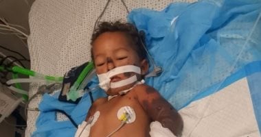 رحل قبل أن يكتمل حلمه.. وفاة الطفل الفلسطيني سند محمد شمعة بعد معاناة مع مرض نادر داخل غزة.. الأطباء بتروا ثلاثة من أطرافه واقترب بتر الطرف الرابع.. نزح مع أسرته إلى خيمة في غزة ولم يمهله الألم فرصة للنجاة