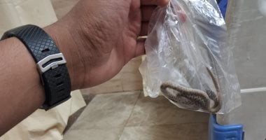 مواطن قناوي يصطحب ثعبانا لدغه للمستشفى داخل كيس لتحديد العلاج المناسب
