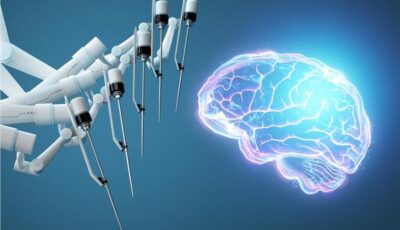 الذكاء الاصطناعي يقتحم غرفة العمليات.. استئصال ورم دماغي بدقة قياسية