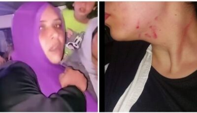 اعتداء لفظي وجسدي.. سيدة تنهال على فتاة بالضرب والعض داخل ميكروباص وتشوه وجهها