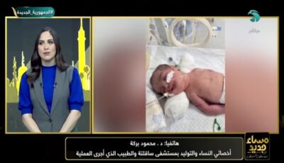 كيف ولد توأم حيًا بعد وفاة أمهما بسوهاج؟ أخصائي نساء يكشف التفاصيل