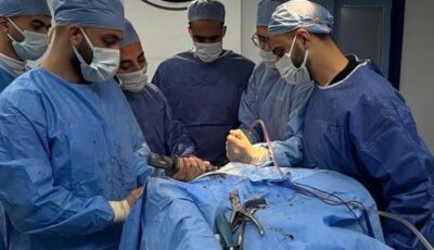 إجراء 4 عمليات جراحية ذات مهارة للعظام بمستشفى العريش العام