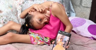 سيلا أبو كريم.. شظية في الظهر وطفولة معلقة بين الألم والأمل داخل غزة