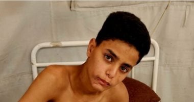 صرخة تامر جمعة.. طفل نجا من القصف ولم تنج طفولته من آثار الحرب داخل غزة